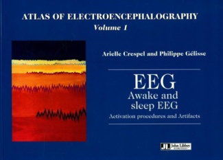 Awake and sleep EEG activation procedures and artifacts. 1