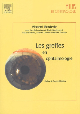 Les greffes en ophtalmologie