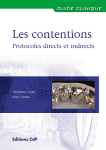 Les contentions. Protocoles cliniques directs et indirects