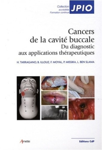 Les cancers de la cavité buccale. Du diagnostic aux applications thérapeutiques