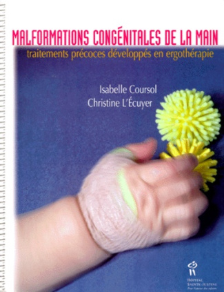 MALFORMATIONS CONGENITALES DE LA MAIN. Traitements précoces développés en ergothérapie