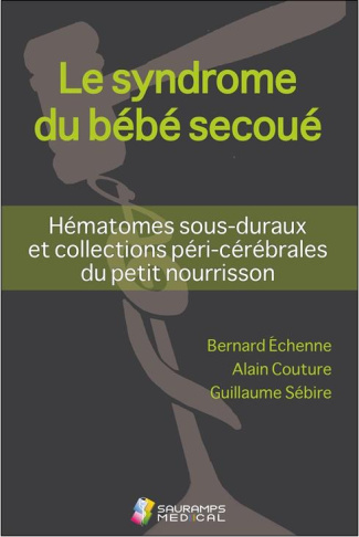 Le syndrome du bébé secoué. Hématomes sous-duraux et collections péri-cérébrales du petit nourrisson