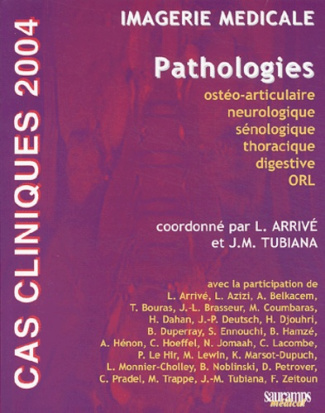 Arriv_Lionel_Azizi_Louisa_Belkacem_A_Bouras-Imagerie_m_dicale._Pathologies_Edition_2004-9782840233527_0