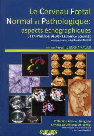 Bault_Jean-Philippe_Loeuillet_Laurence_Benoist-Le_cerveau_foetal_normal_et_pathologique_aspects_chographiques-9782840237754_0