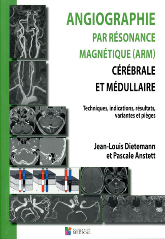 Dieteman_Jean-louis_Anstett_Pascale-Angiographie_par_r_sonance_magn_tique_ARM_c_r_brale_et_m_dullaire._Techniques_indications_r_sult-9791030300741_0