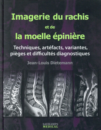 Dietemann_Jean-Louis-Imagerie_du_rachis_et_de_la_moelle_pini_re._Techniques_art_facts_variantes_pi_ges_et_difficult_s-9782840239673_0