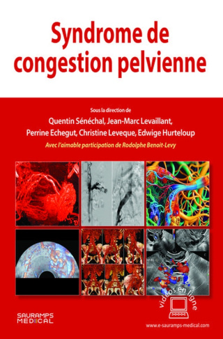 LEVAILLANT-SYNDROME_DE_CONGESTION_PELVIENNE-9791030304787_0