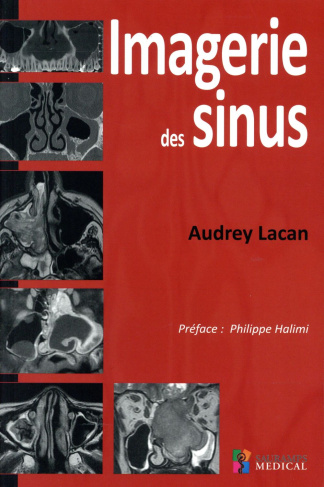 Lacan_Audrey_Halimi_Philippe-Imagerie_des_sinus-9791030300710_0