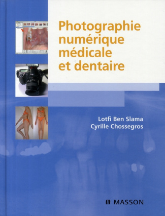 ben-slama-lotfi-3b-chossegros-cyrille-photographie-numerique-medicale-et-dentaire_0