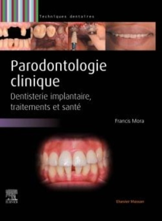 mora-francis-parodontologie-maladie-parodontale-decision-therapeutique-traitements-implantologie_0
