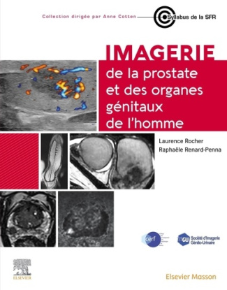 rocher-laurence-renard-penna-raphaelle-imagerie-de-la-prostate-et-des-organes-genitaux-de-l-homme_0